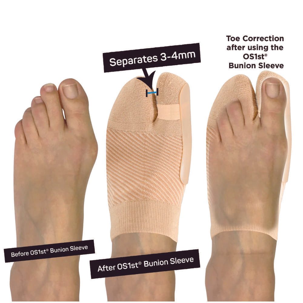 Bunion Bracing Sleeve (HV3) - Natural - Image 2