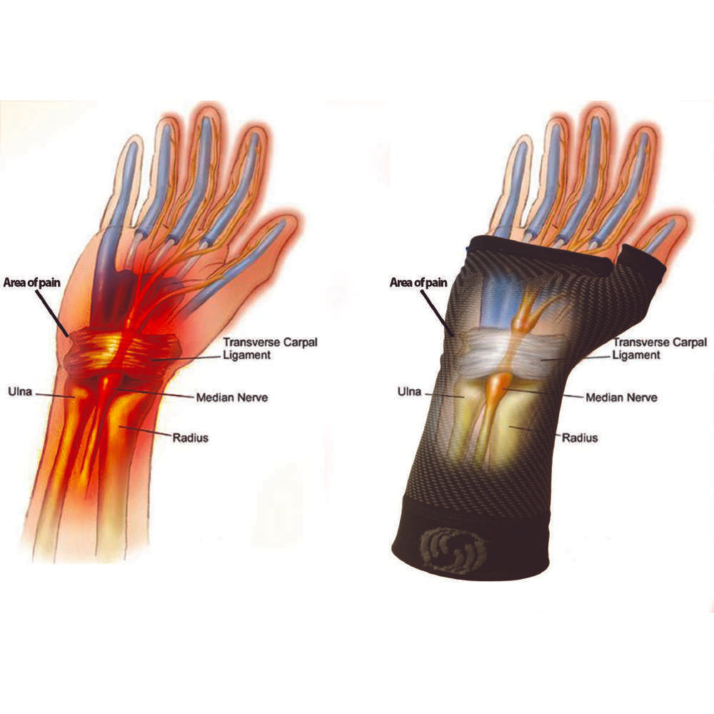 Sports Wrist Compression Sleeve (WS6) - Black - Image 6