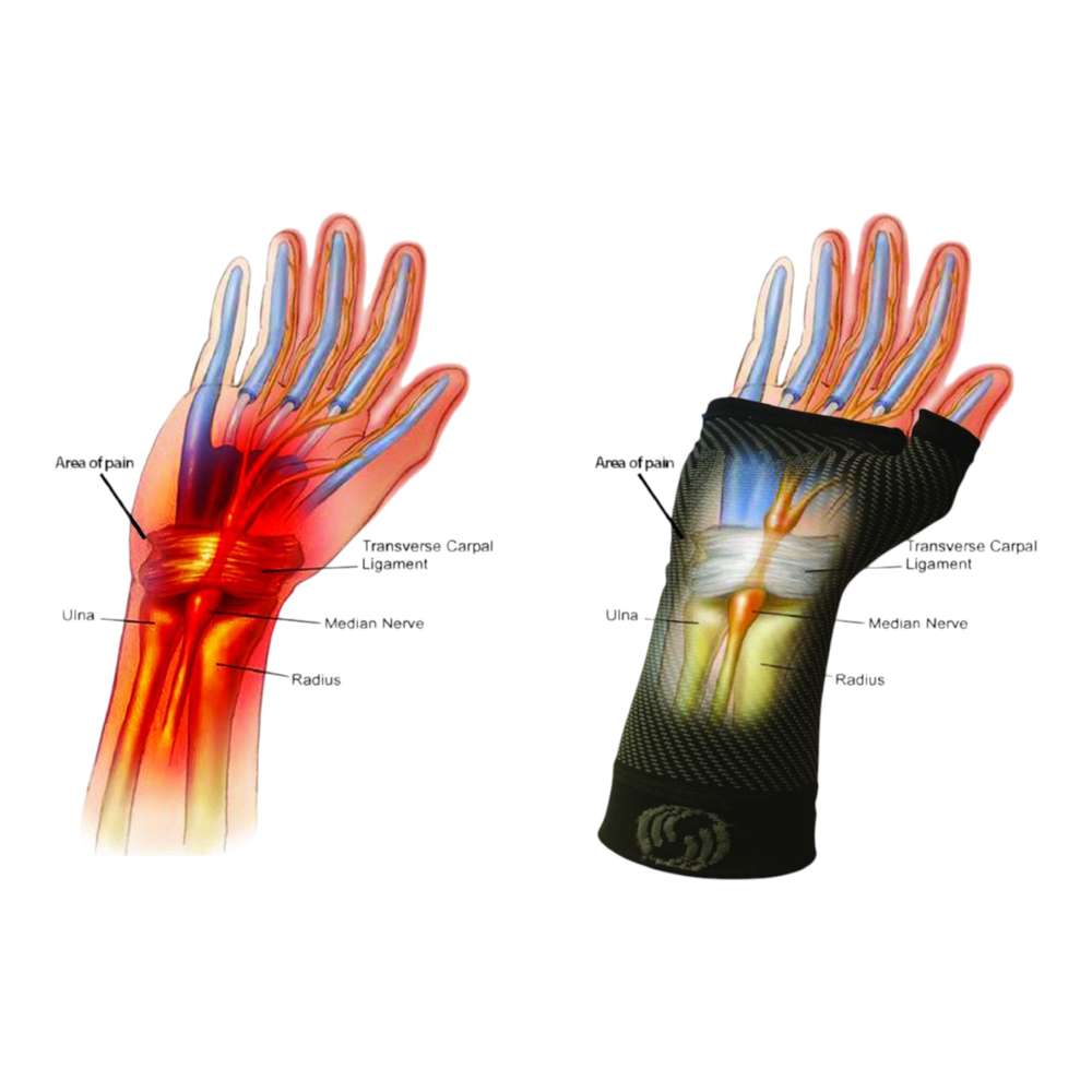 Sports Wrist Compression Sleeve (WS6) - Natural - Image 2
